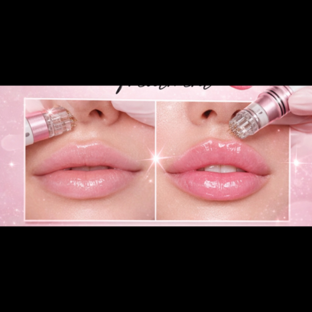 💋 Lip Hydration Booster (No Filler at Flawless Spa & Beauty in Fort Worth, TX