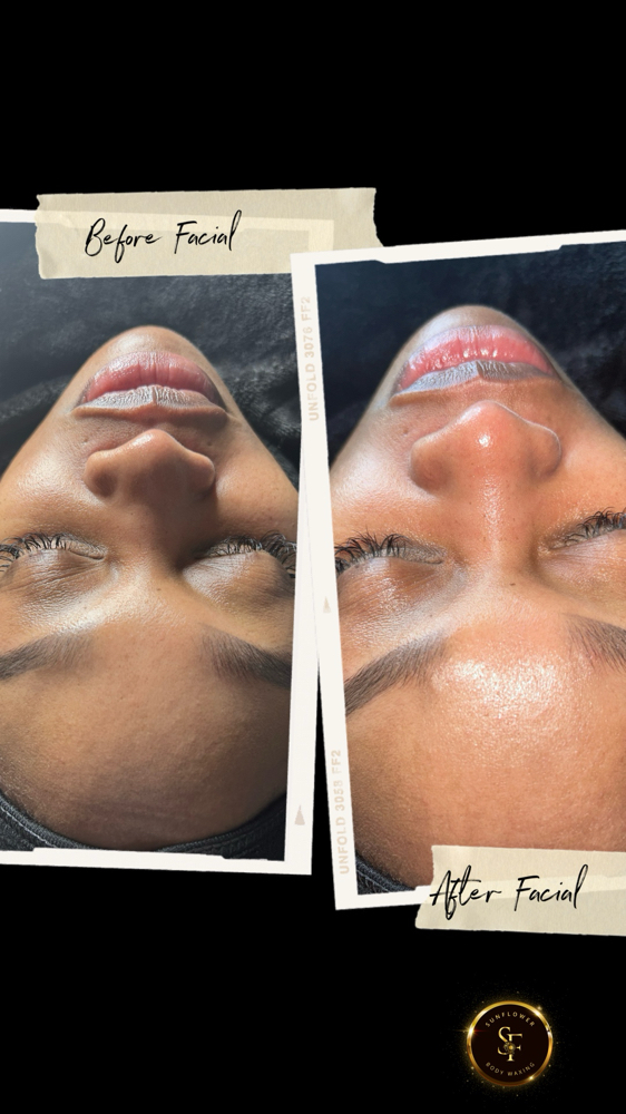 Sunflower 5 Star Glow Elite Facial