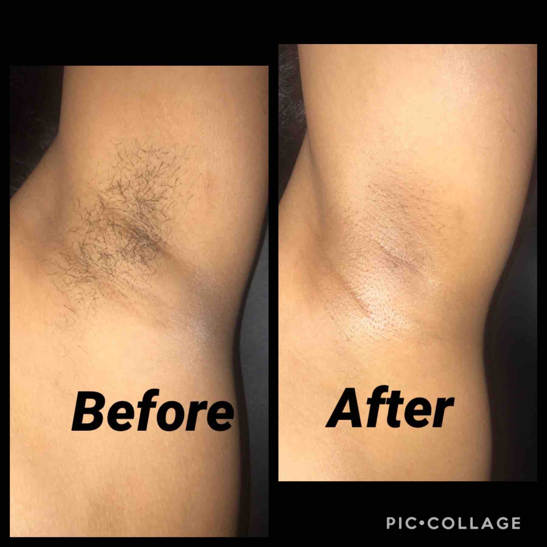 Underarm Wax