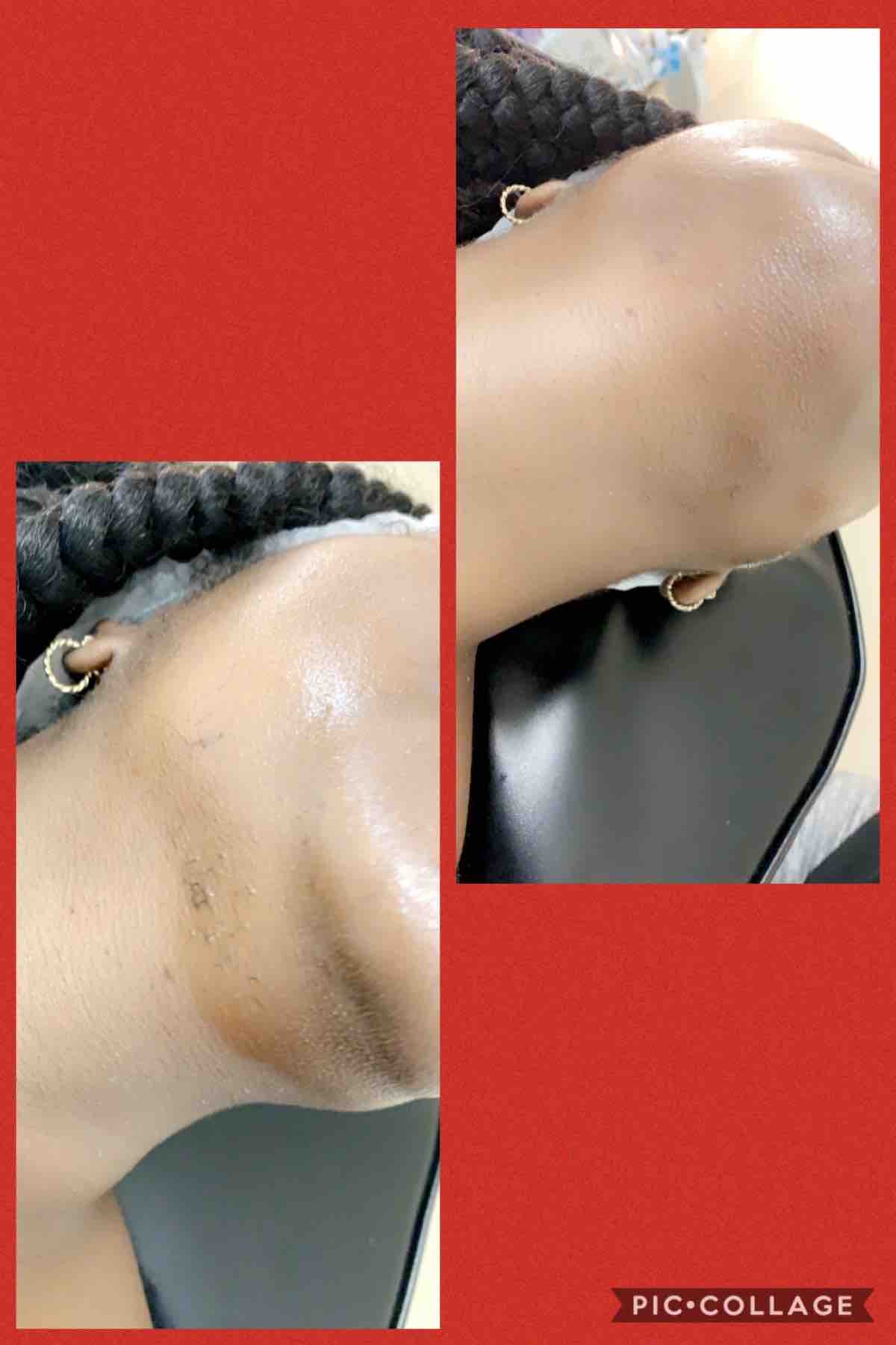 Neck Wax