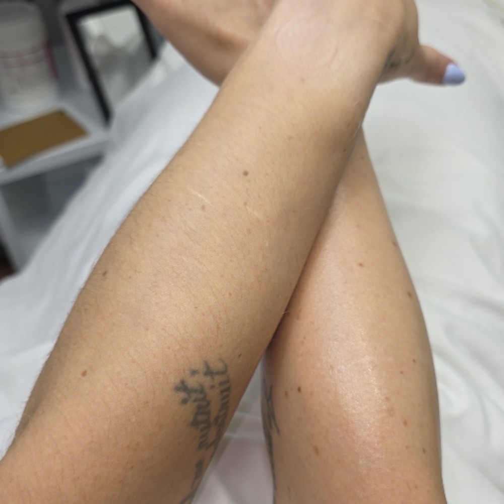 Full Arm Wax at Celtic Spa Laser Services in Attleboro, MA