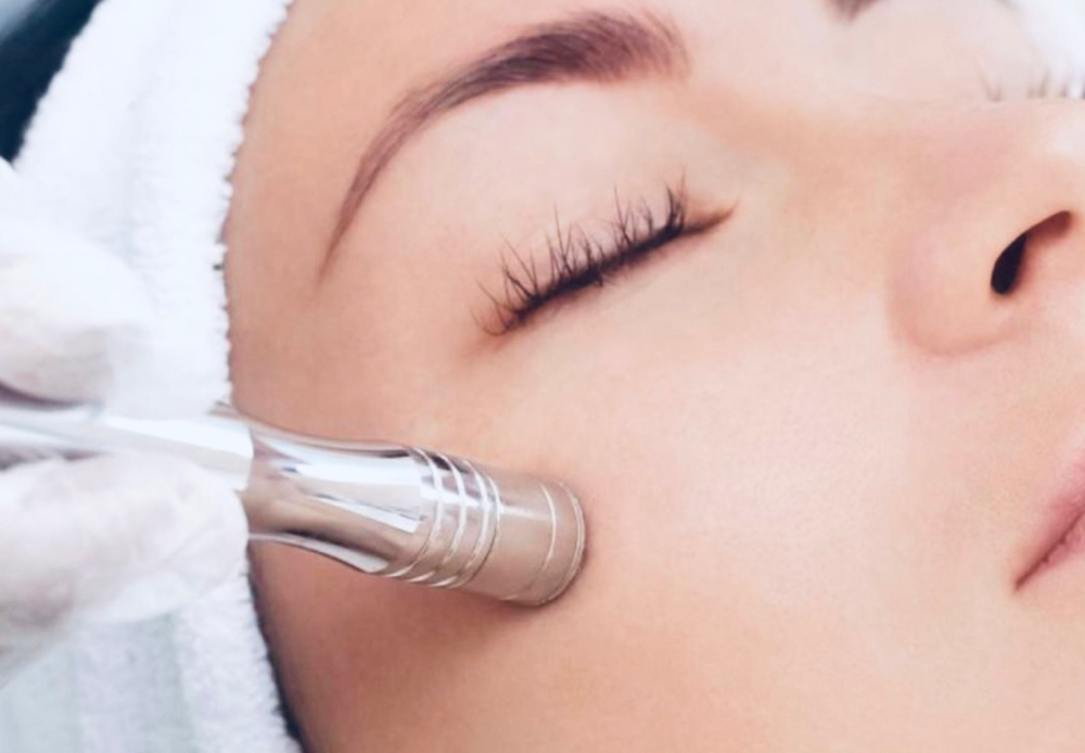 Microdermabrasion Facial