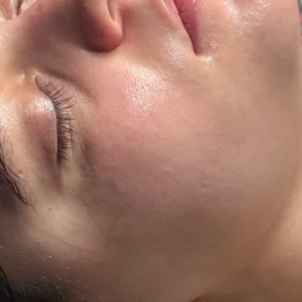 Refine & Renew Peel - III at Skin by Gia in Pueblo, CO