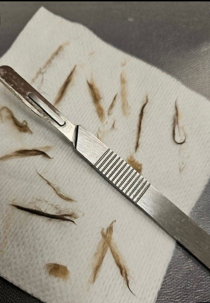 dermaplaning