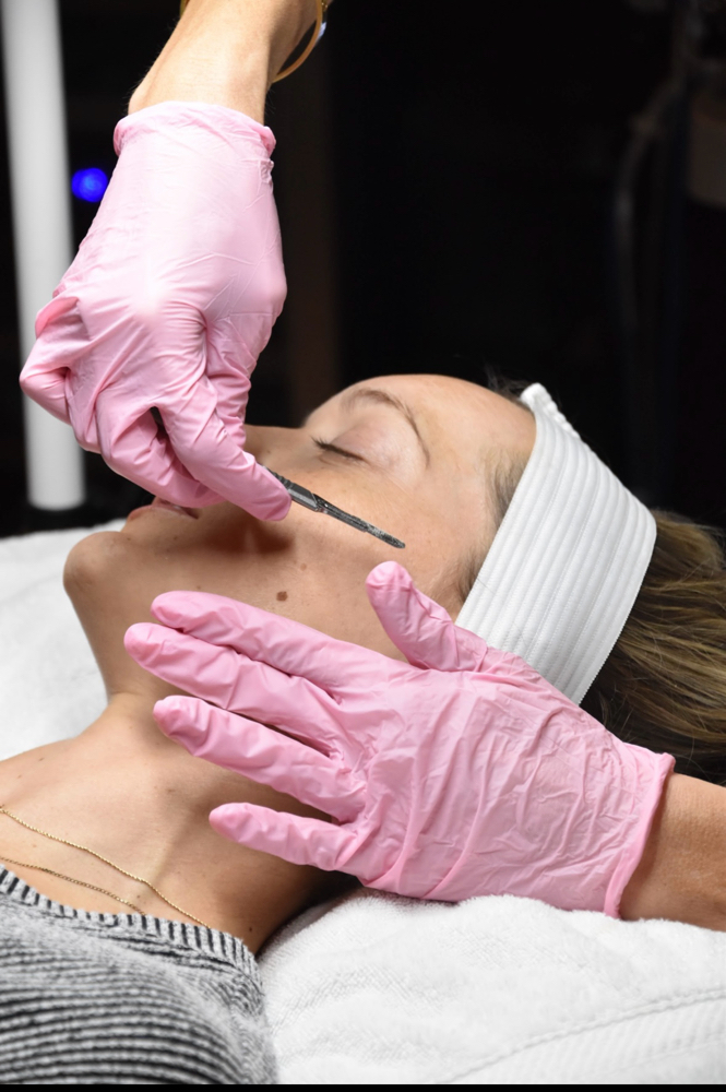 Dermaplane Facial at Skin Aesthetics Studio in East Bernard, TX