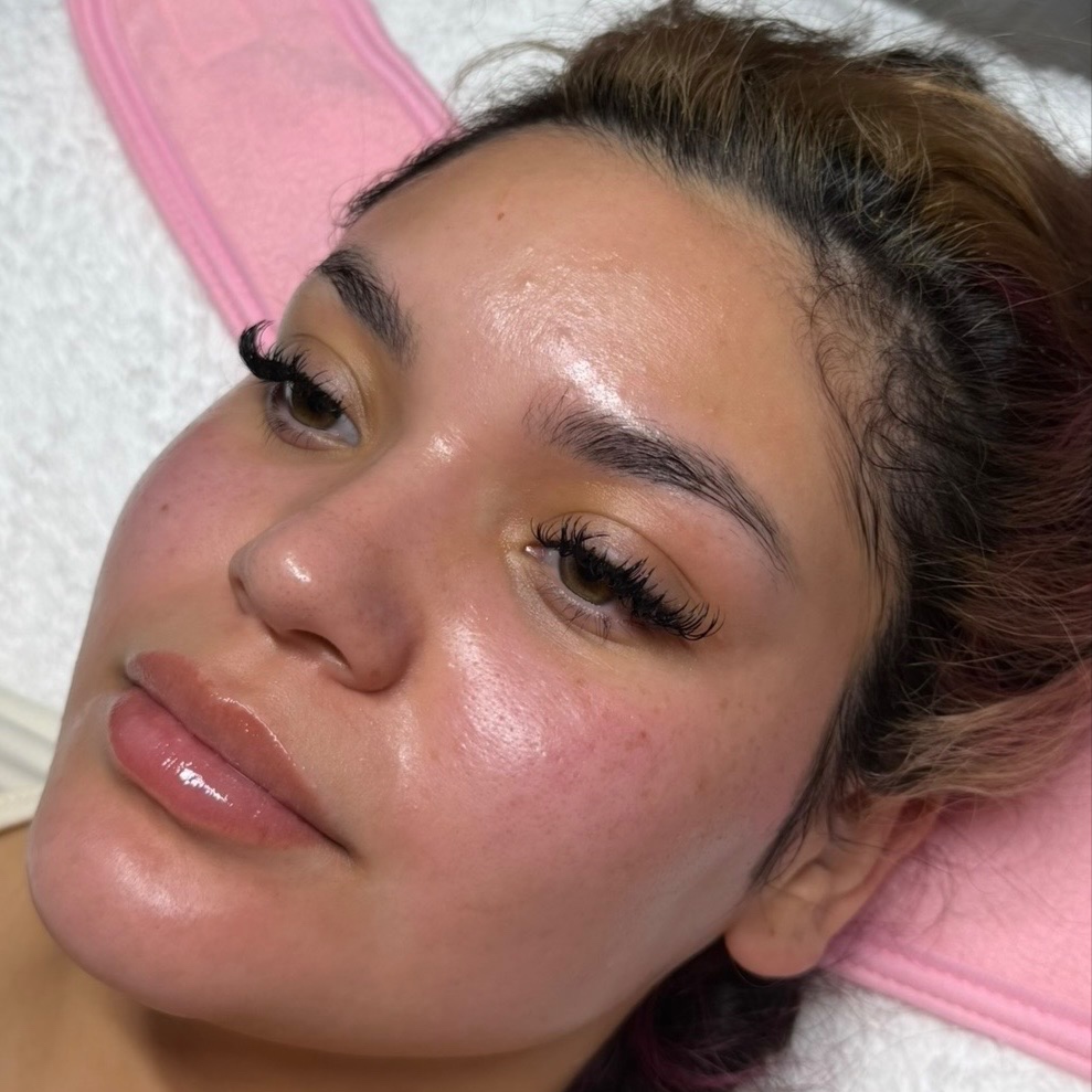 Dermaplane Facial at HALO SKN ESTHETICS in Killeen, TX