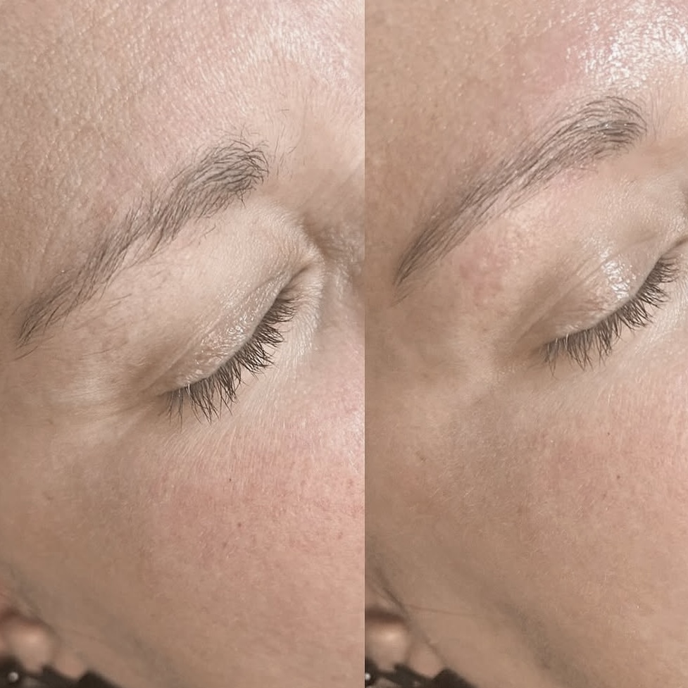 Brow Shaping
