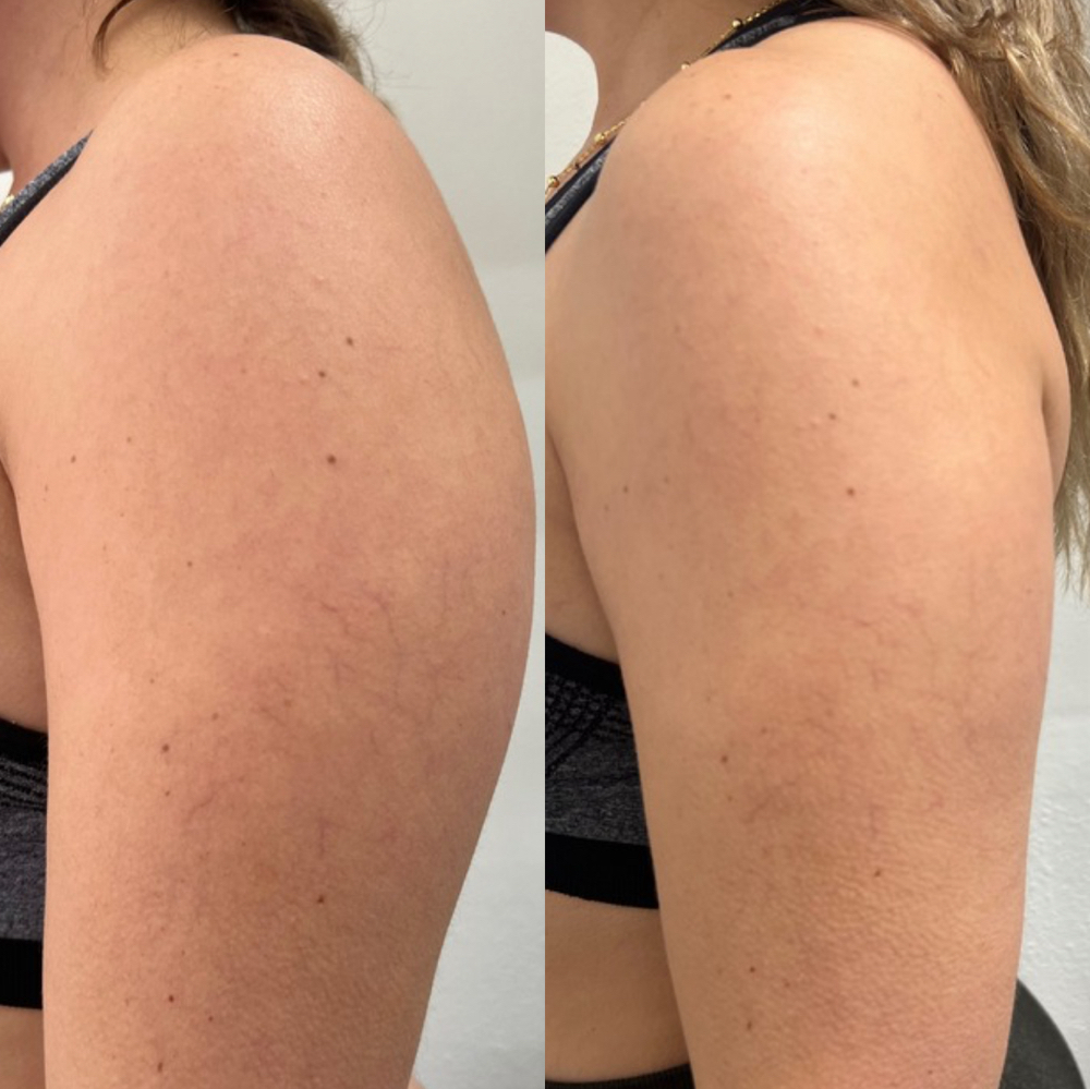 Arm Contour