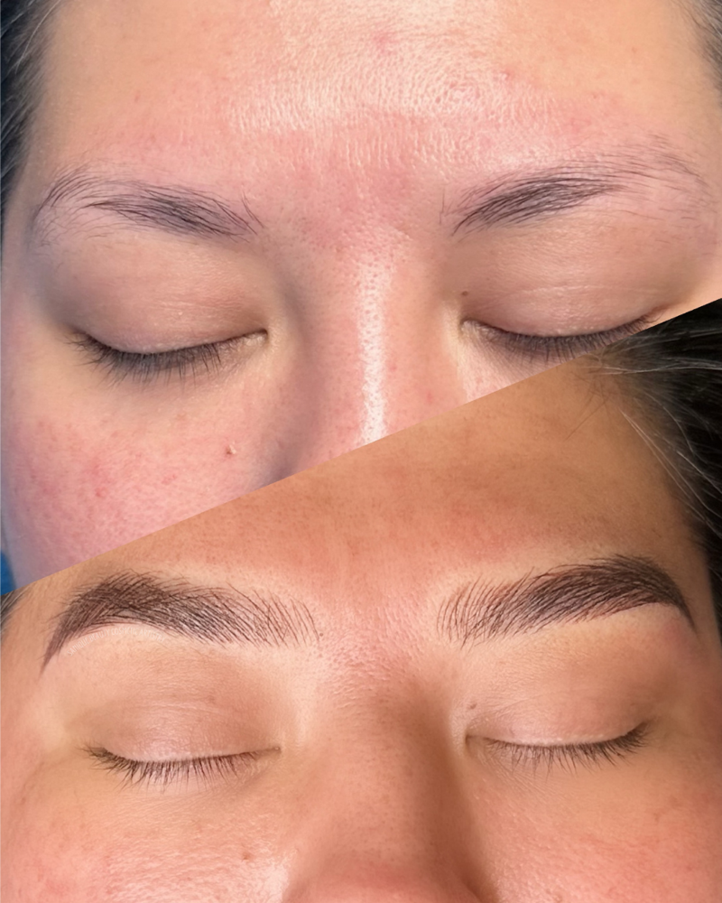 Microblading