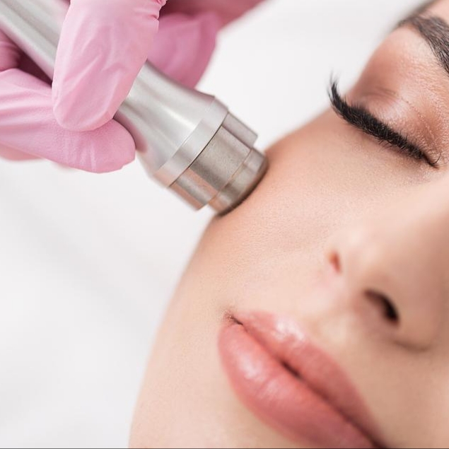 Microdermabrasion