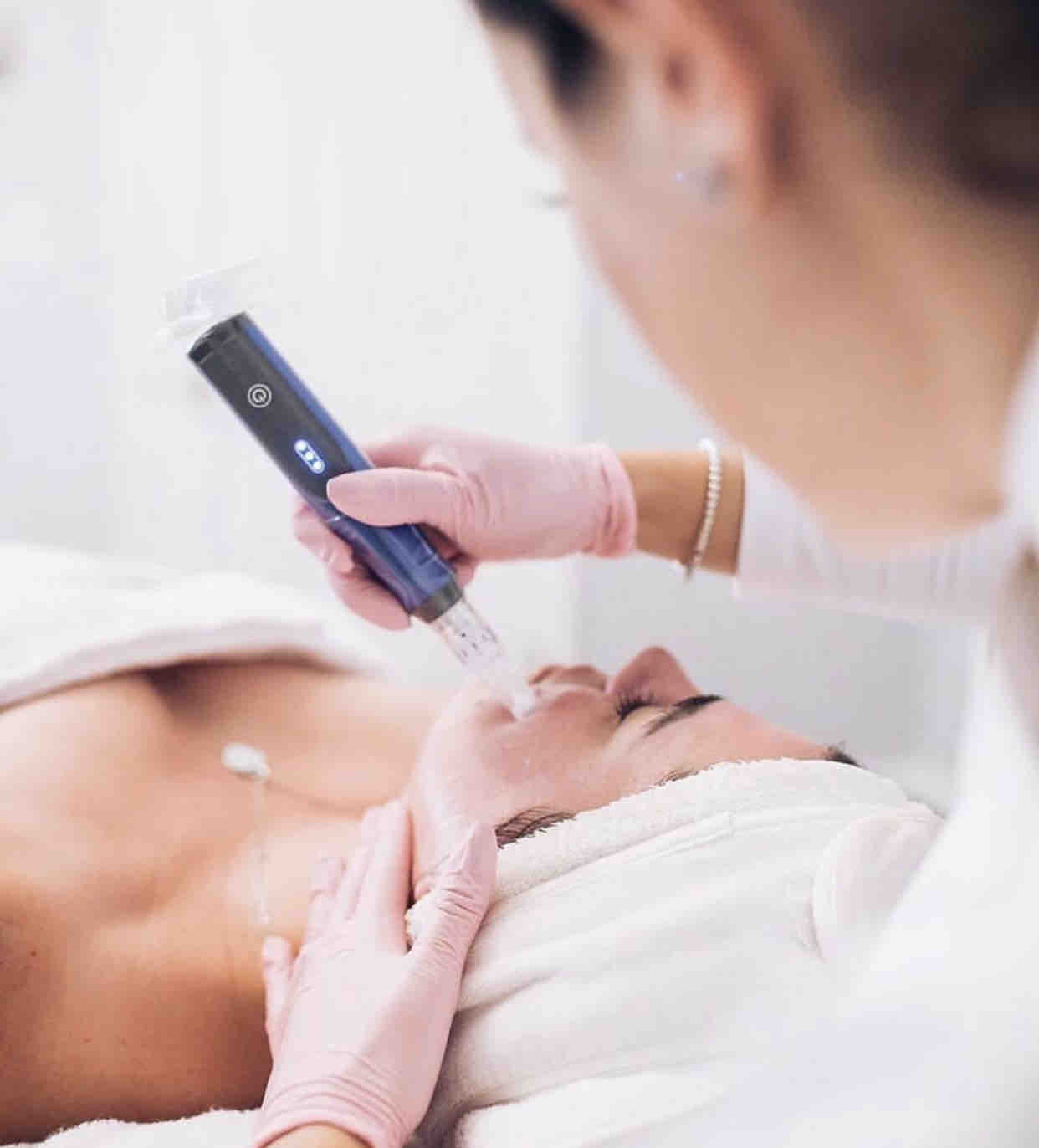 Microneedling [Package Of 2]