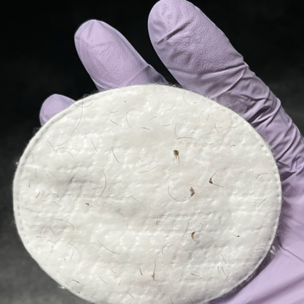 INGROWN AND DARK SPOT TREATMENT at Untamed Radiance in Lanham, MD