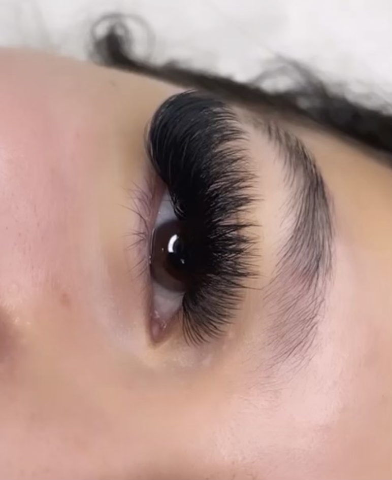 Mega Volume Fill