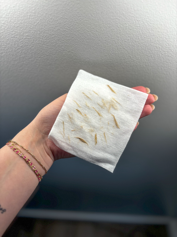 Dermaplane Treatment