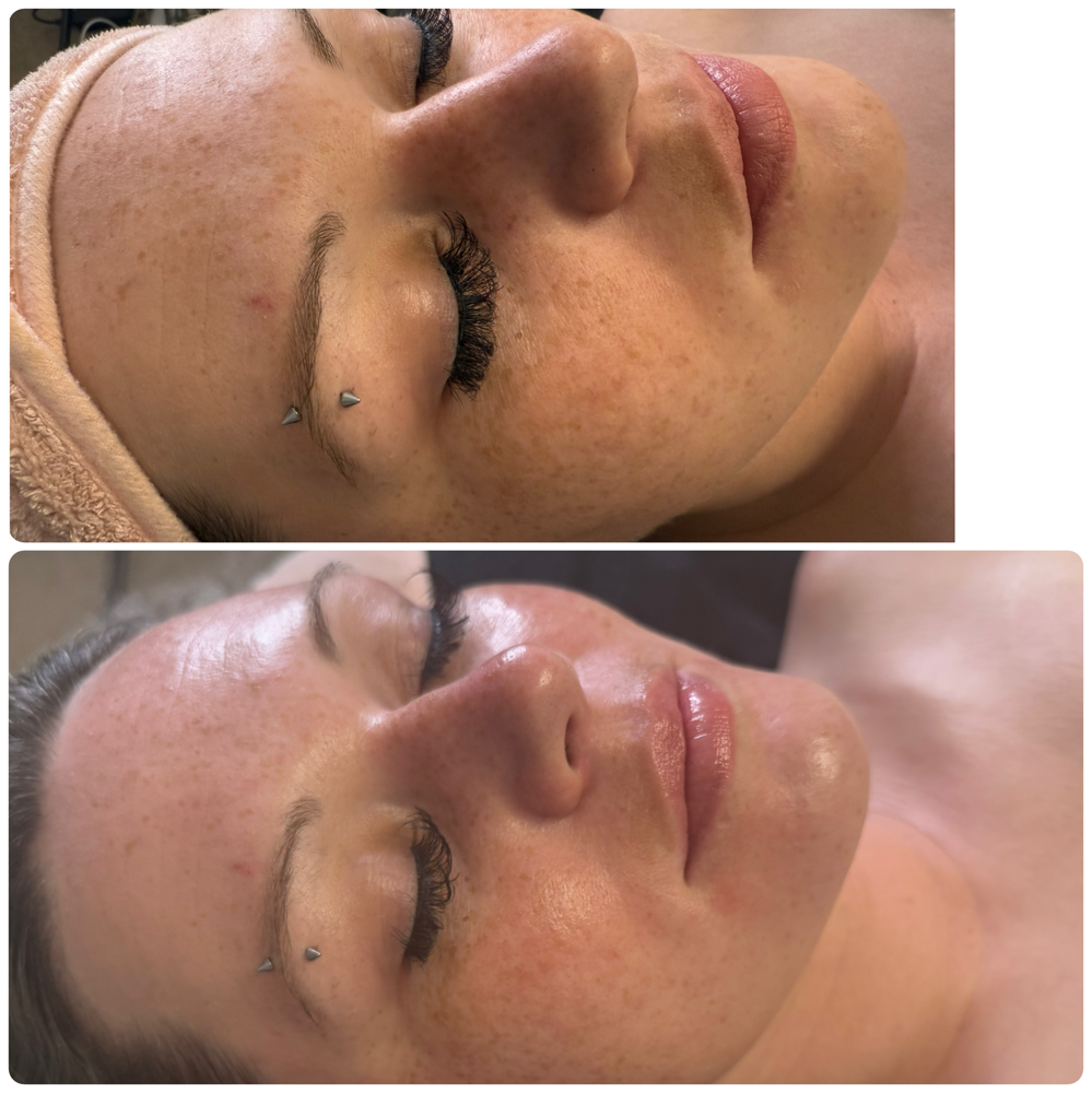 RADIANCE Brightening Facial