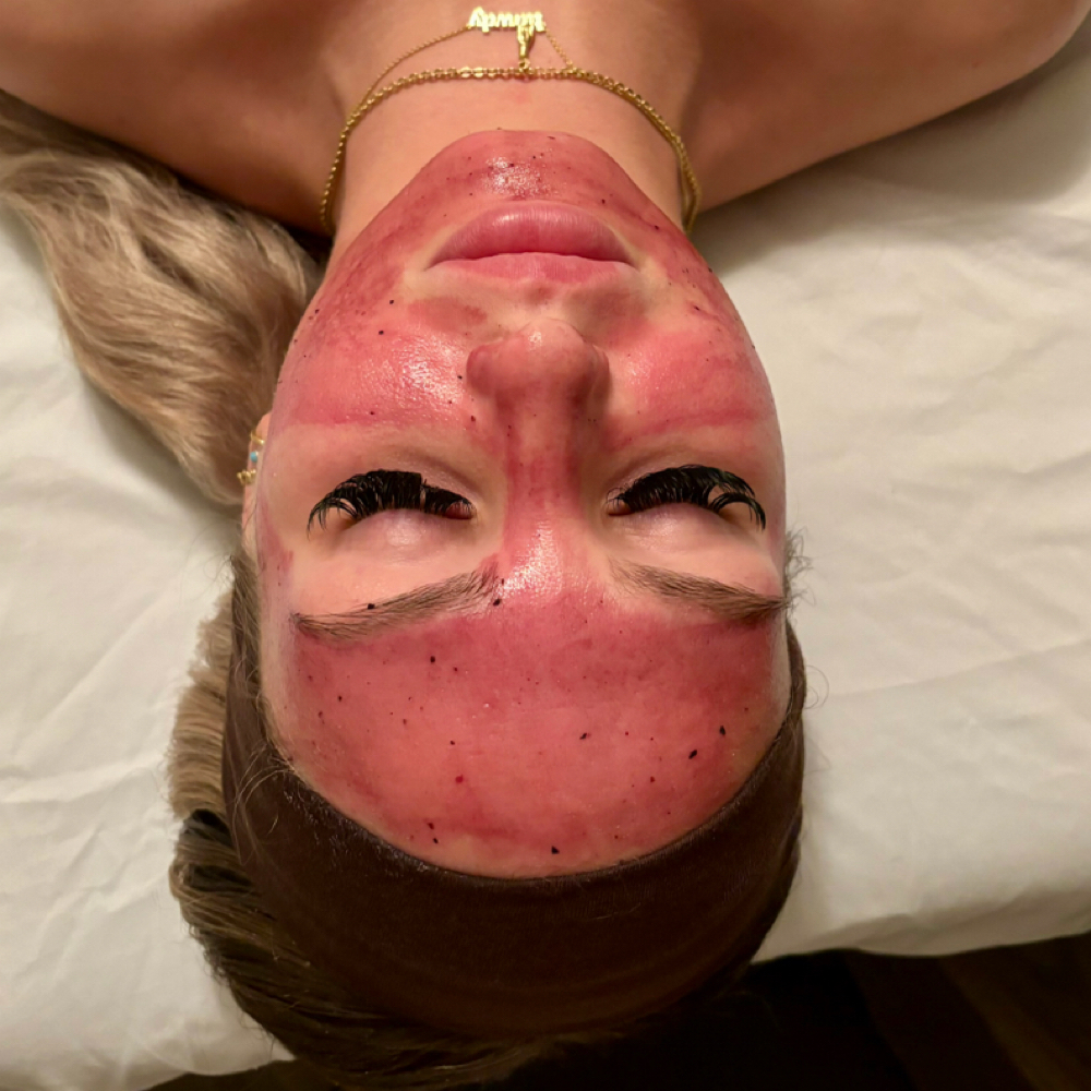 Diamond Microdermabrasion Facial at Poppy Esthetics in Wichita Falls, TX