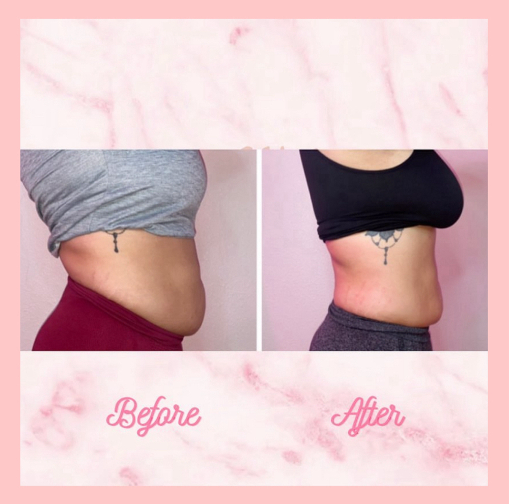 3 Package Lipo360