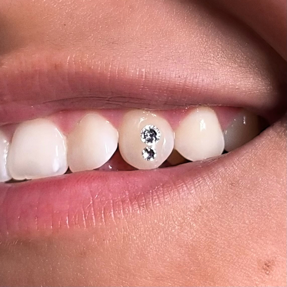 $35 Ea/ 2 For $65 CRYSTAL TOOTH GEM
