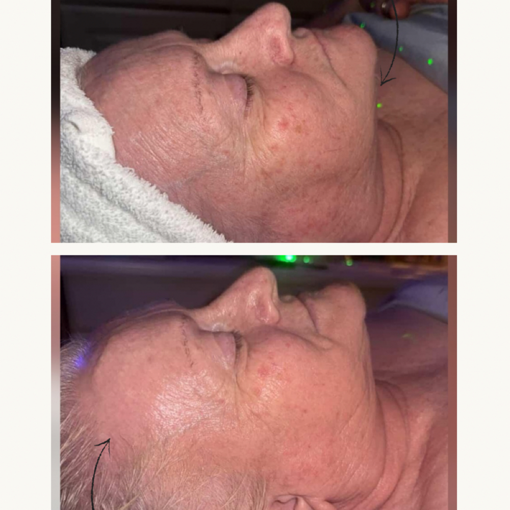 Joyful Peel & Polish at Shades of Joy Esthetics in Lodi, CA