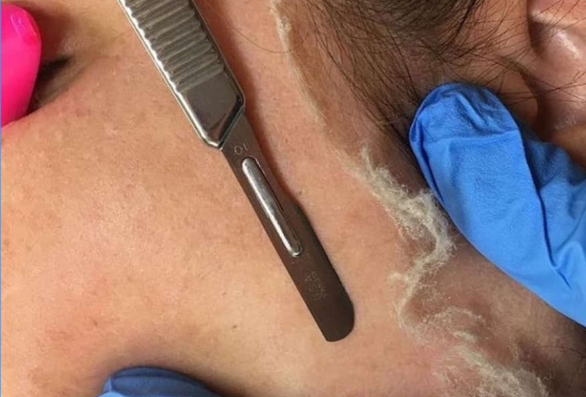 Dermaplaning Facial - Stand Alone