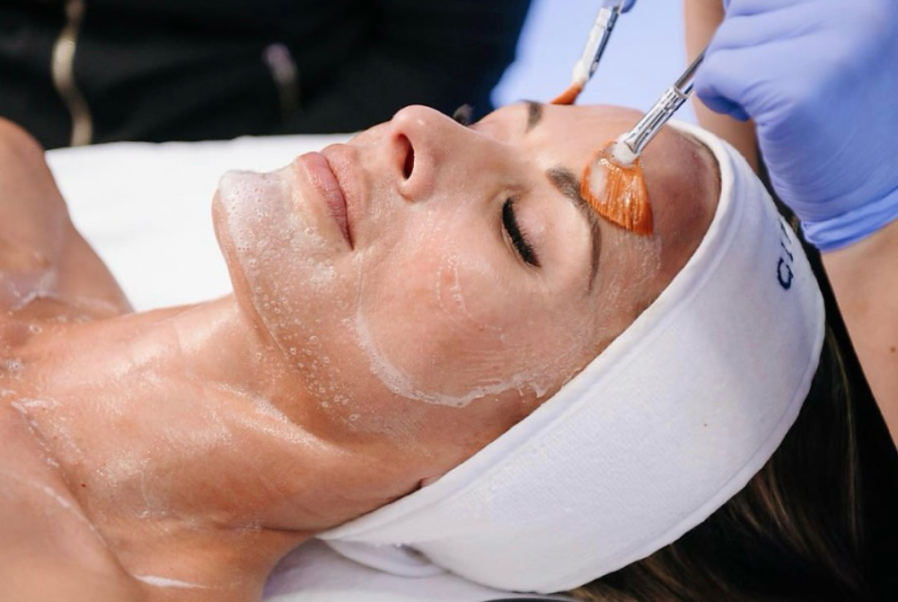 Circadian Chemical Peel