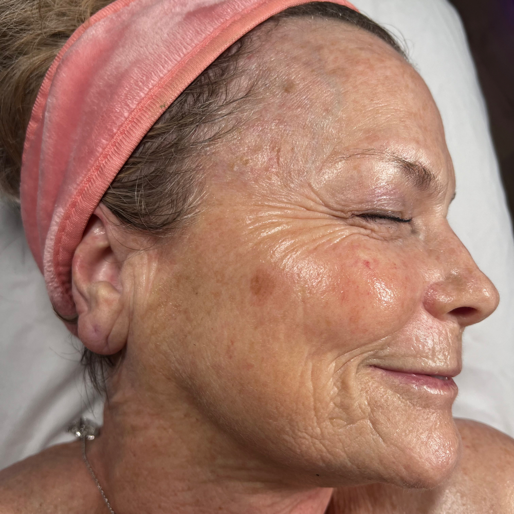 Anti Aging Facial