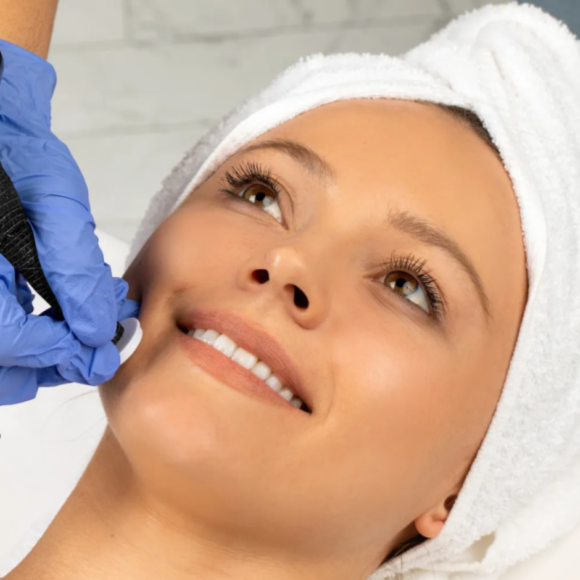 Microchanneling at Dime Aesthetics MedSpa in Choteau, MT