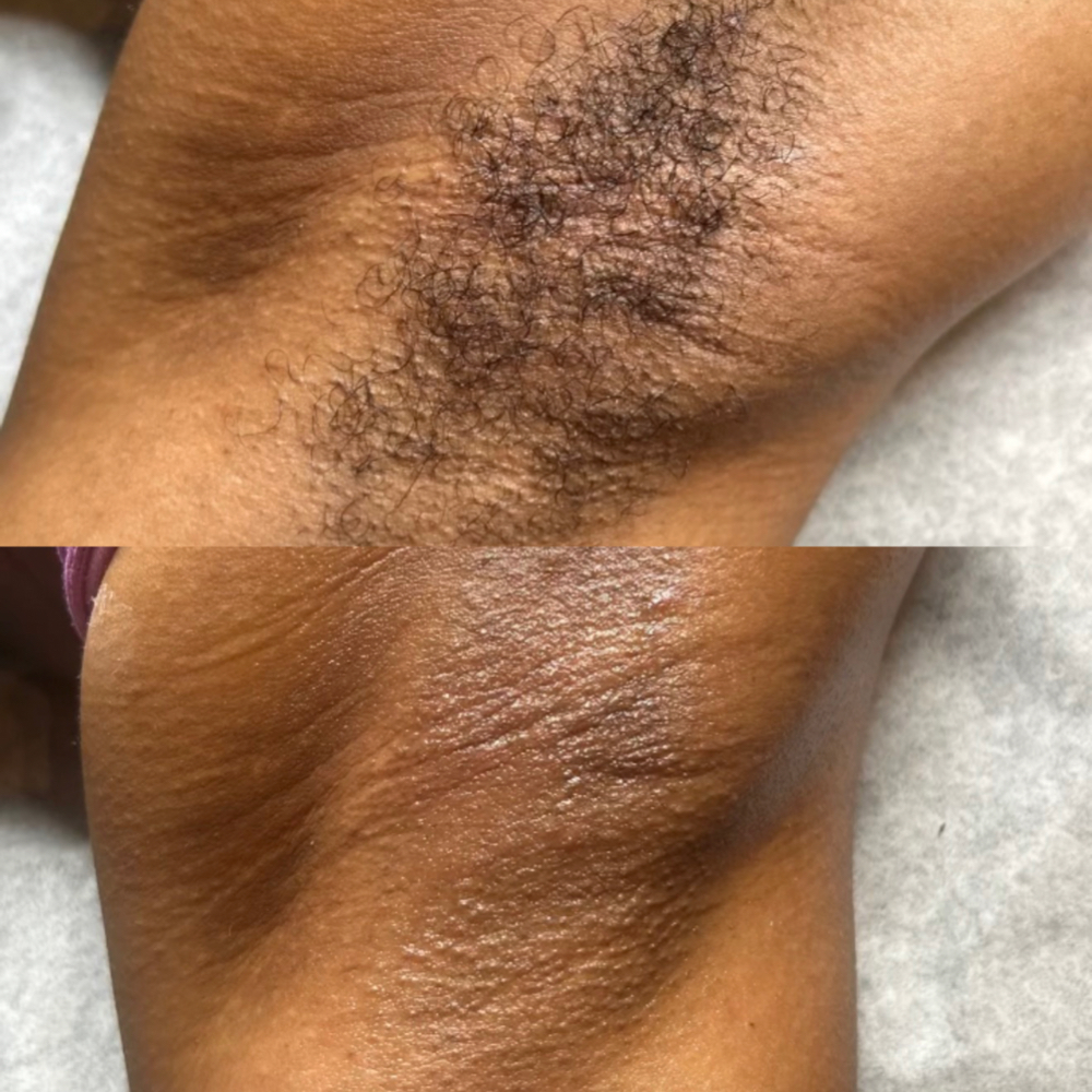 Underarm Wax at The SKN Studio in Greenville, NC