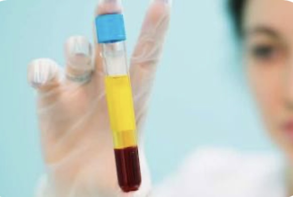 PRP Add on  2 Vials