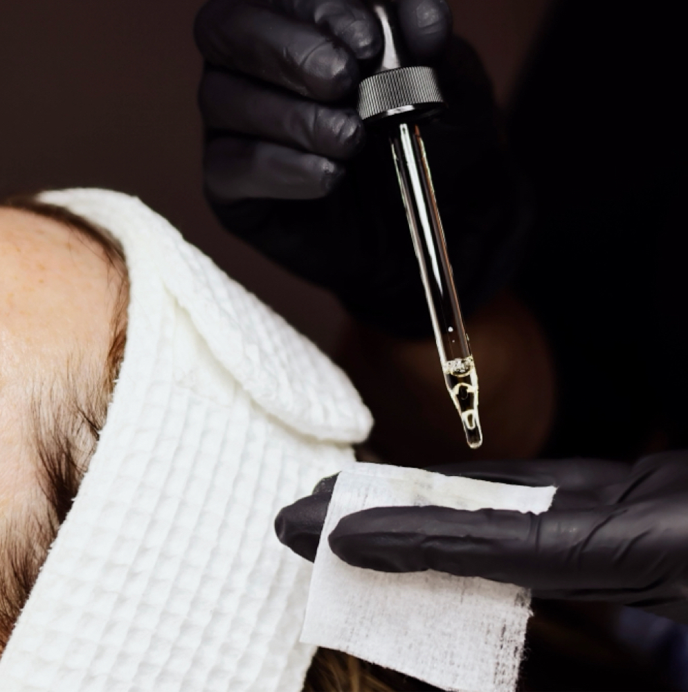 Epionce Refresh Chemical Peel