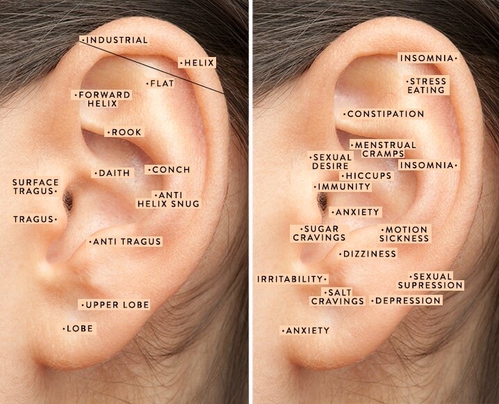 Acupressure Ear Seeds