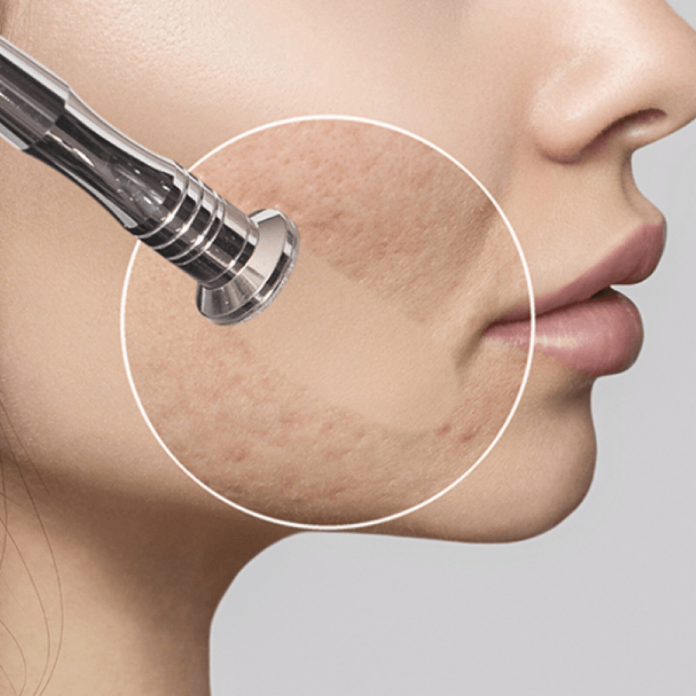 Treatments & Add Ons at giusiskin in Pasadena, TX