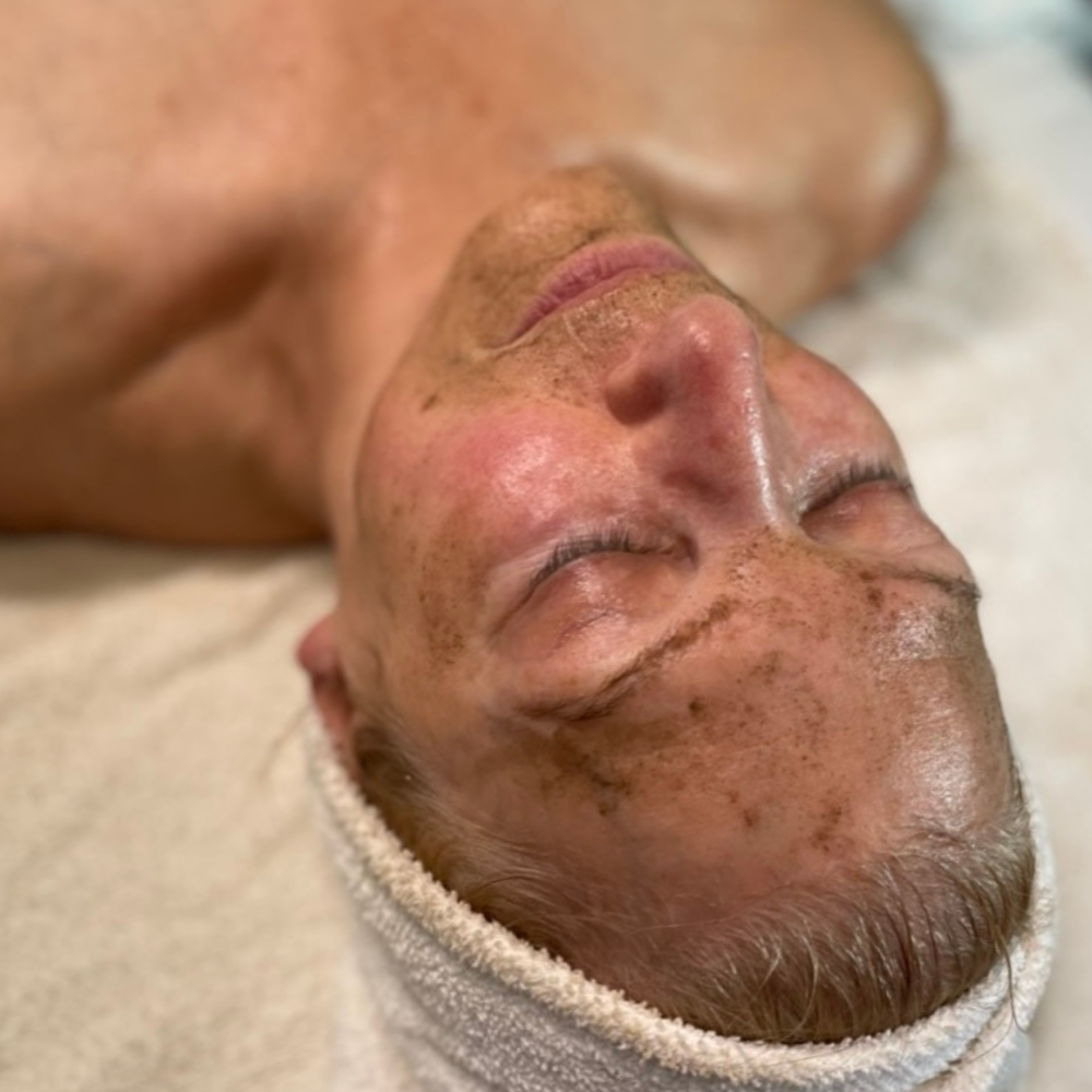 The Bespoke Bio-Needling Facial