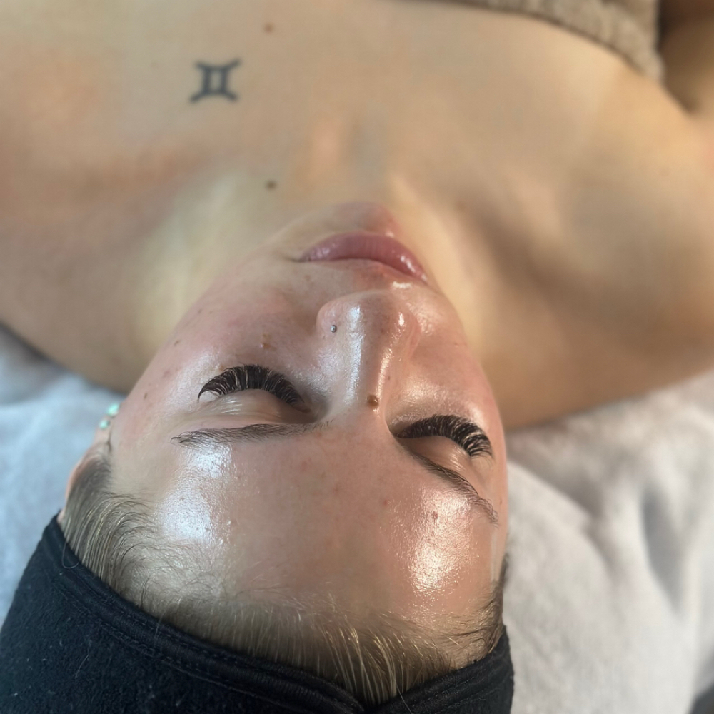 Dermaplane at Elayna McCarter in Thornton, CO