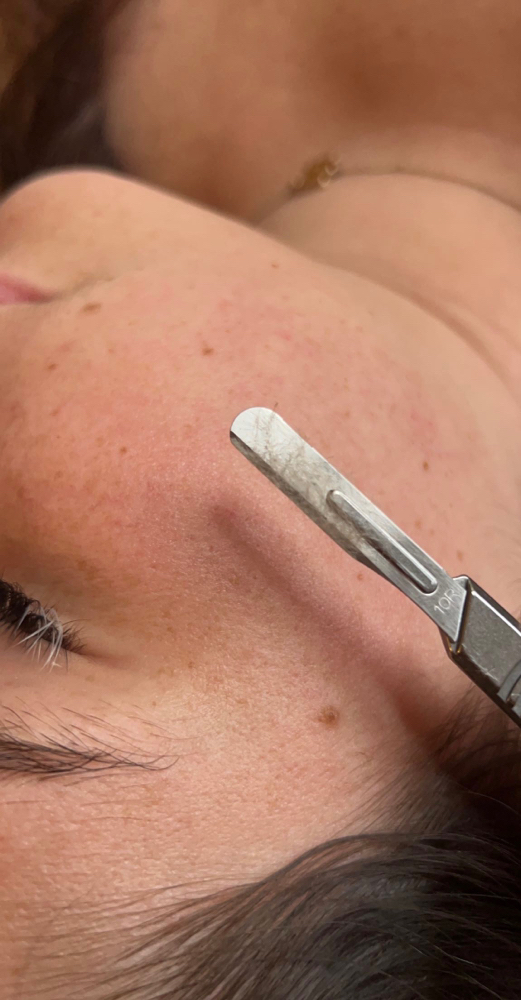 Dermaplane Facial