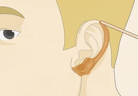 Ear Wax at Ari•ology in Waterford, MI