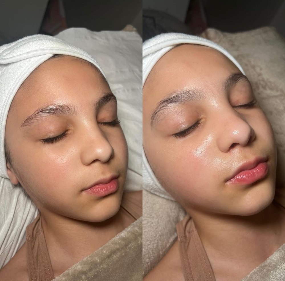 Teen Facial Treatment