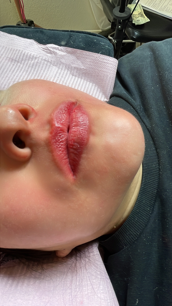 Lipblush