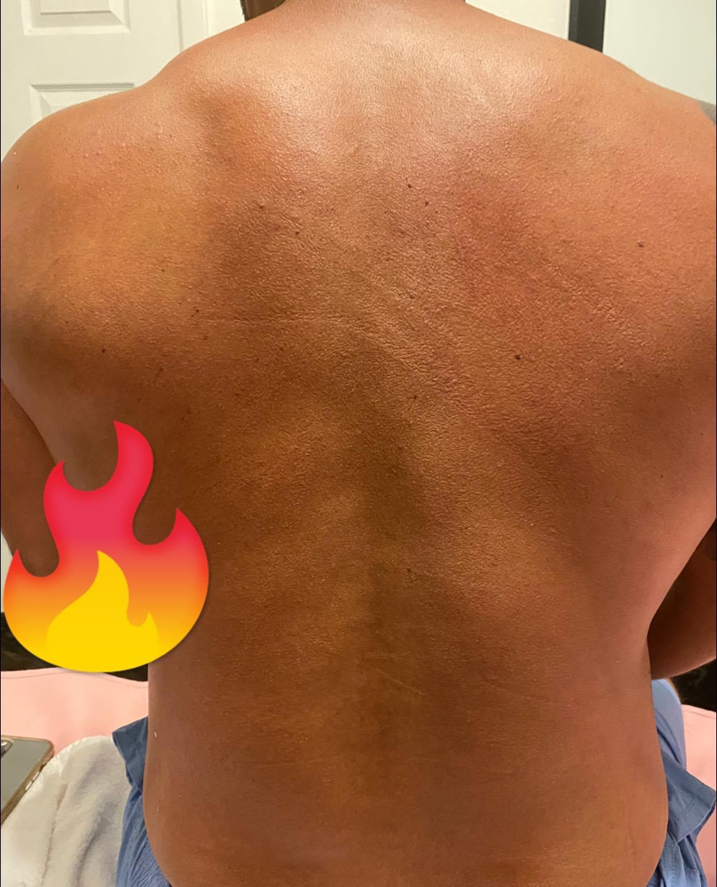 Back Oh Back