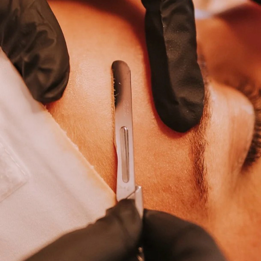 The Resurface (Dermaplane Facial) at Hair Cureology Salon & Scalp Spa in Belleville, IL