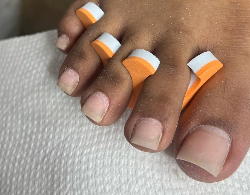 Acrylic Toe Fill In