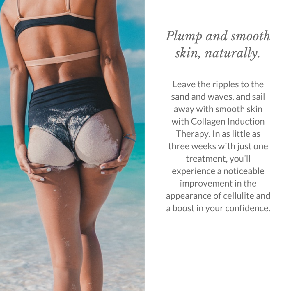 Cellulite Reduction