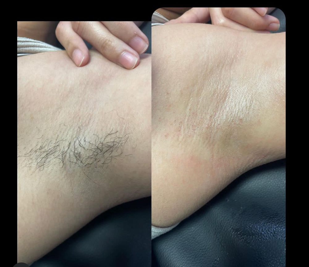 Underarms Wax