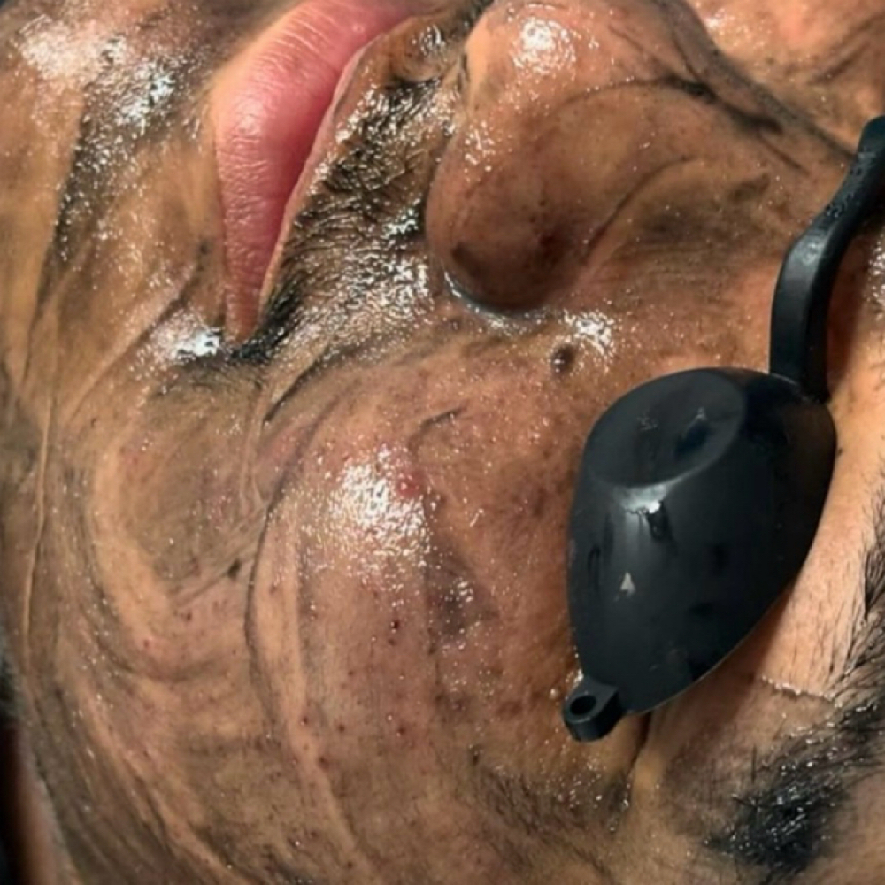 Men’s Facial at Welcome to Skin Beauty Aesthetics. in Wilson, NC