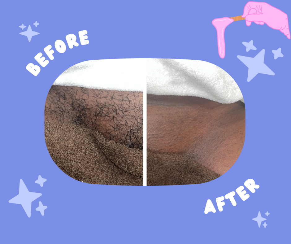 Full Brazilian Wax