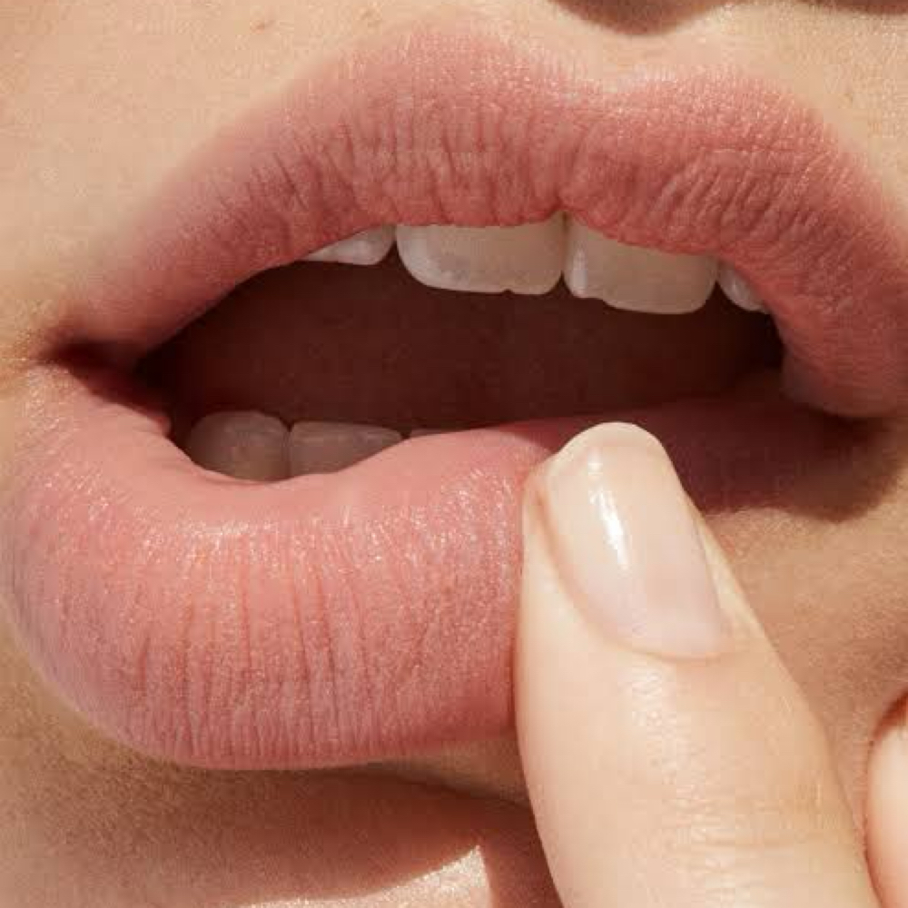Lip Filler at Bare Coast Aesthetics in Houston, TX