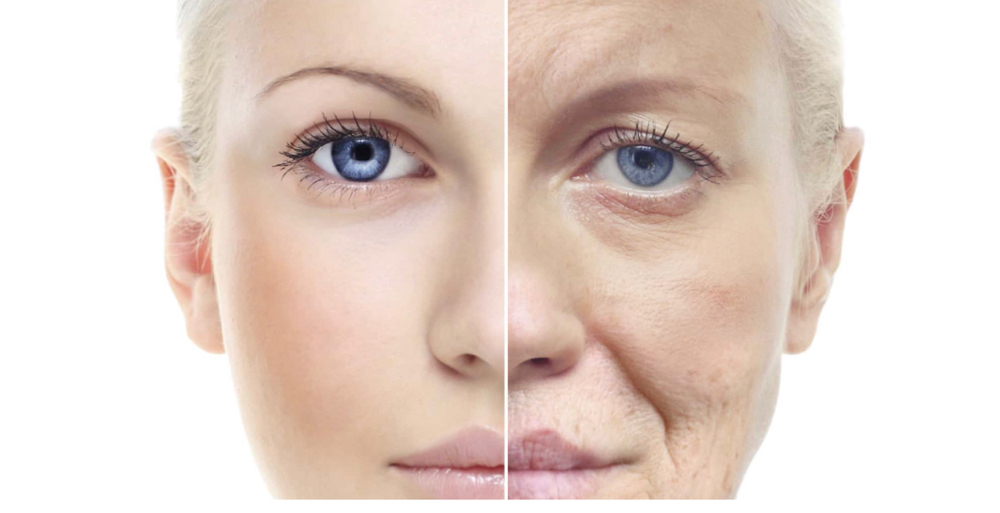 RF Therapy/Anti-Aging Treatment