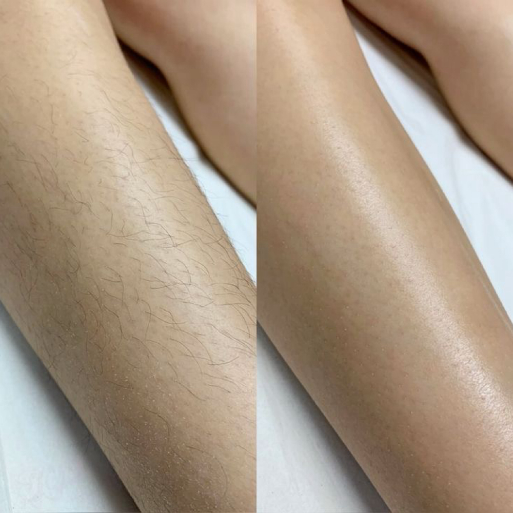 DEPILACION DE PIERNAS at GMLASHESPR in Caguas, PR