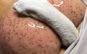 Peach Facial  (booty Facial)
