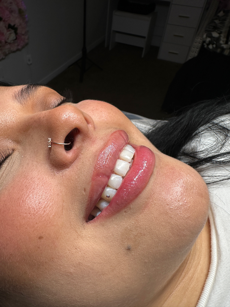 1 Single Tooth Gems
